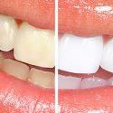 Eagle Heights Dental Care - Dentists Hobart 1