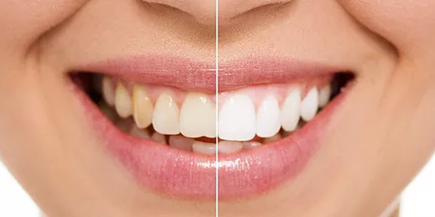 Newcastle Dental Care - Dentists Hobart 3