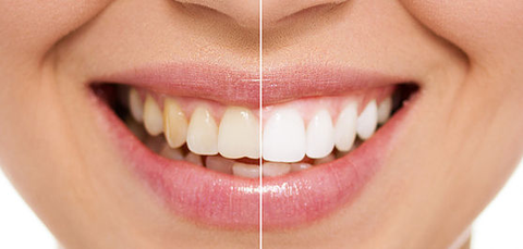 Newcastle Dental Care - Dentists Hobart 7