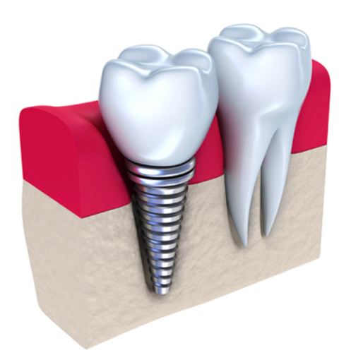 Honeysuckle Dental - Dentists Hobart 7