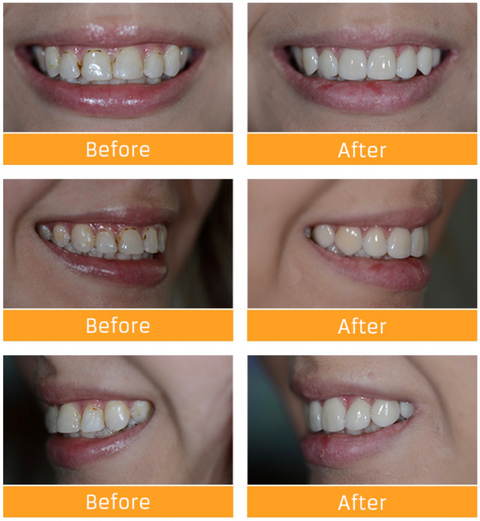 Honeysuckle Dental - Dentists Hobart 8