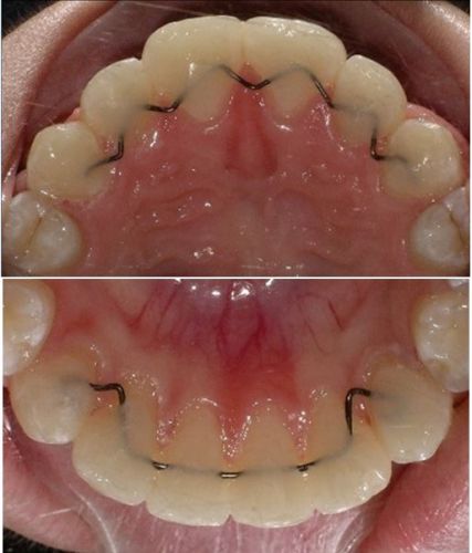 Hunter Valley Orthodontics - Dentists Hobart 19