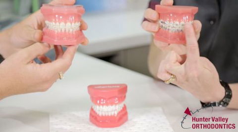 Hunter Valley Orthodontics - Dentists Hobart 30
