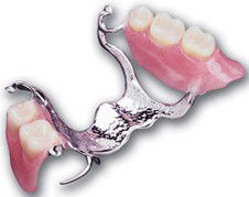 Noble Denture Design - Dentists Hobart 2