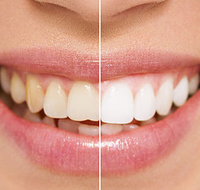 All About Smiles Kincumber - Dentists Hobart