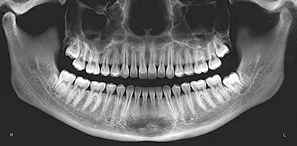 Terrigal Dental - Dentists Hobart 3