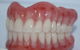 Advance Oral Denture Clinic - thumb 11