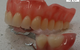 Advance Oral Denture Clinic - thumb 12