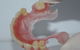 Advance Oral Denture Clinic - thumb 15