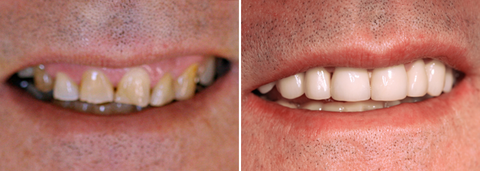 Charlestown Dentalcare - Dentists Hobart 2