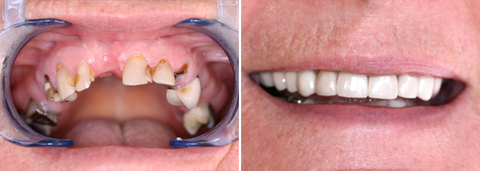 Charlestown Dentalcare - Dentists Hobart 3