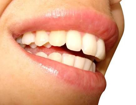 Affordable Dental Care - Dentists Hobart 5