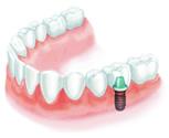 Sunrise Dental - Dentists Hobart 5