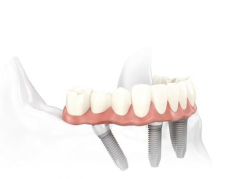 Specialist Oral Surgery - Dentists Hobart 0
