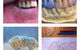 Design A Smile Dental Laboratory Technologies - thumb 2