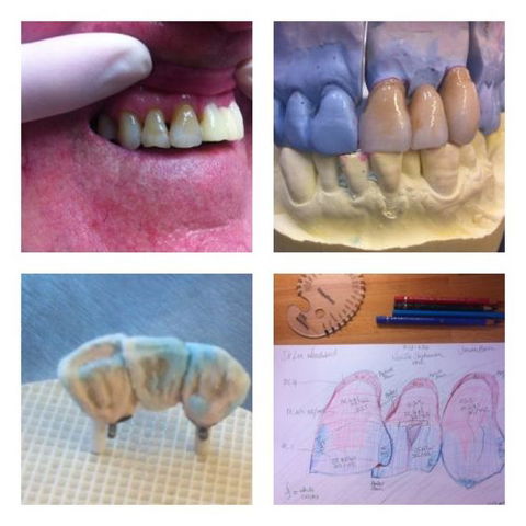 Design A Smile Dental Laboratory Technologies - Dentists Hobart 2