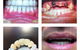 Design A Smile Dental Laboratory Technologies - thumb 3