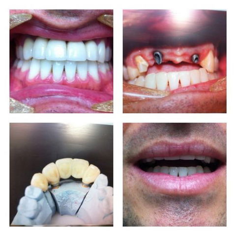 Design A Smile Dental Laboratory Technologies - Dentists Hobart 3