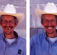 Denture Mt Gravatt - Dentists Hobart