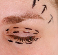 Queensland Plastic Surgery - Dentists Hobart