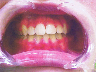 Central Gosford Orthodontics - Dentists Hobart 2