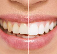 Newcastle Dental Care - Dentists Hobart