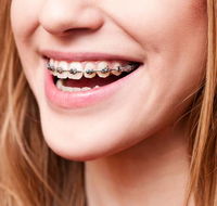 Cairns Specialist Orthodontists - Dentists Hobart