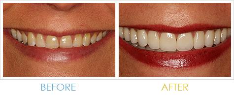 Harris Dental Boutique - Dentists Hobart 2