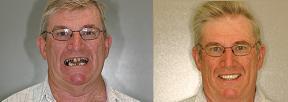 Harris Dental Boutique - Dentists Hobart 3
