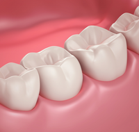 Coastal Dental Implants - Dentists Hobart