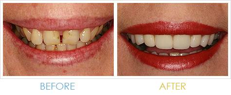 Harris Dental Boutique - Dentists Hobart 6
