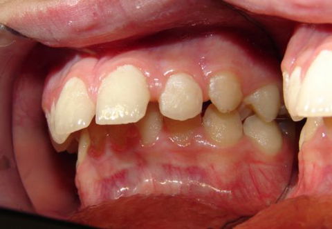 Smiling Wide Orthodontics - Dentists Hobart 2