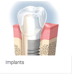 Aura Dental Centre - Dentists Hobart 6