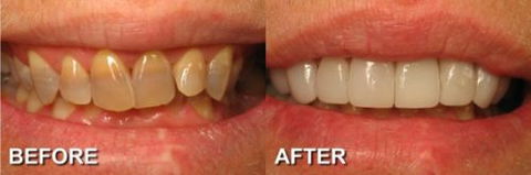 Ooralea Dental Care - Dentists Hobart 4