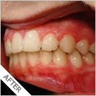 Smiling Wide Orthodontics - Dentists Hobart 11